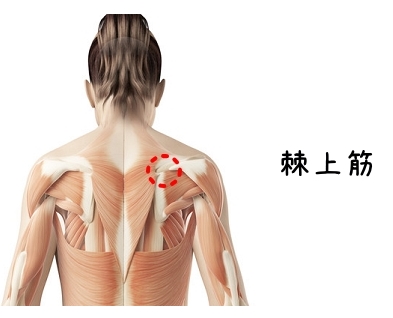 線維筋痛症について