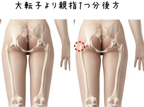 線維筋痛症について