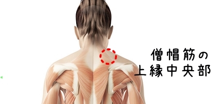 線維筋痛症について