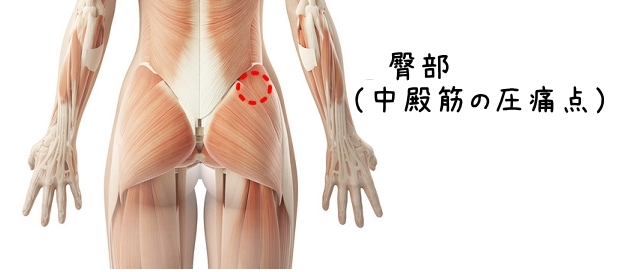 線維筋痛症について