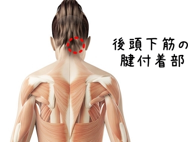 線維筋痛症について